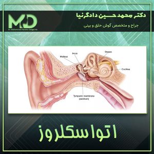 اتواسکلروز - دکتر محمد حسین دادگرنیا