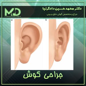 جراحی گوش- دکتر دادگرنیا