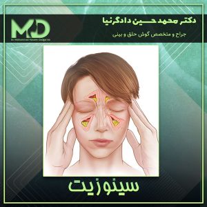 سینوزیت - دکتر محمد حسین دادگرنیا